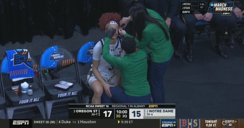 Hannah Hidalgo’s nose ring was forcefully removed during Notre Dame women’s Sweet 16 game
